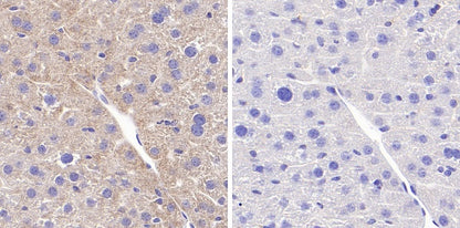 Phospho-GCN2 (T899) Recombinant Rabbit mAb (S-1665-19)