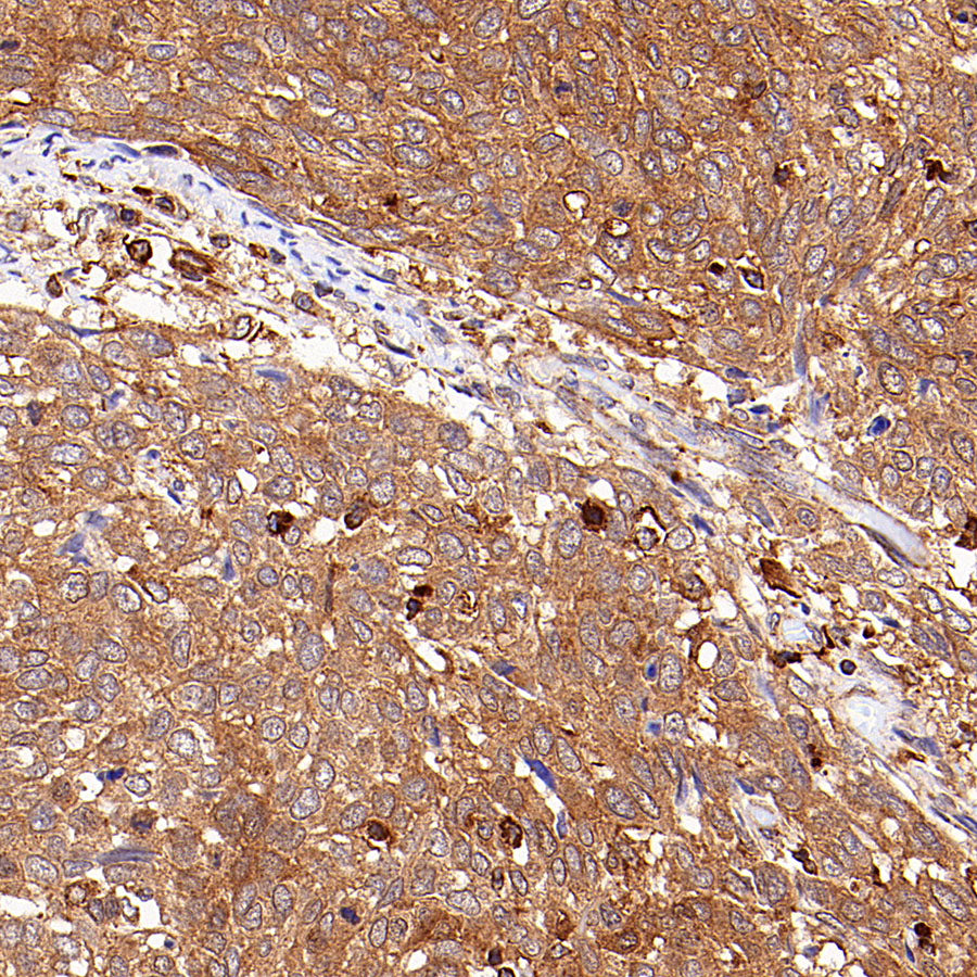 Urokinase Recombinant Rabbit mAb (S-5949)