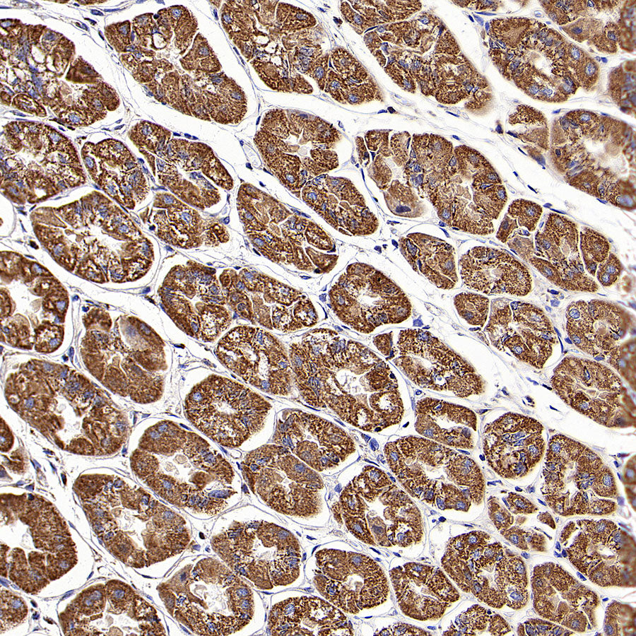 CLPP Recombinant Rabbit mAb (S-4169-31)