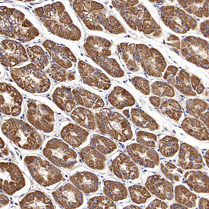 CLPP Recombinant Rabbit mAb (S-4169-31)