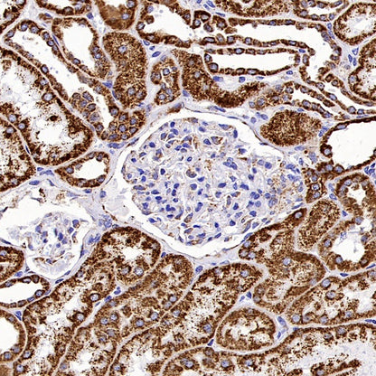 GLS1 Recombinant Rabbit mAb (S-2355-20)