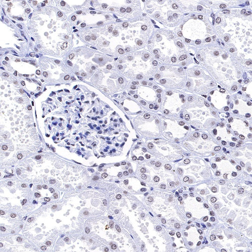 Histone H3 (mono methyl K4) Rabbit polyclonal antibody