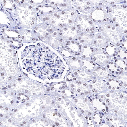 Histone H3 (mono methyl K4) Rabbit polyclonal antibody