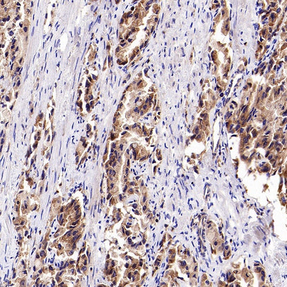Dynamin 2 Recombinant Rabbit mAb (S-1751-209)