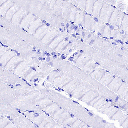 PTK7 Recombinant Rabbit mAb (SDT-2432-156)