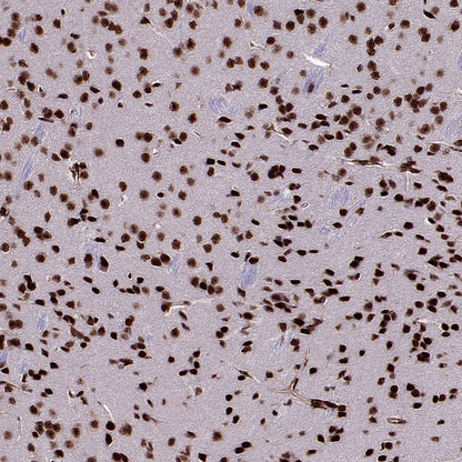 MBD3 Rabbit Polyclonal Antibody