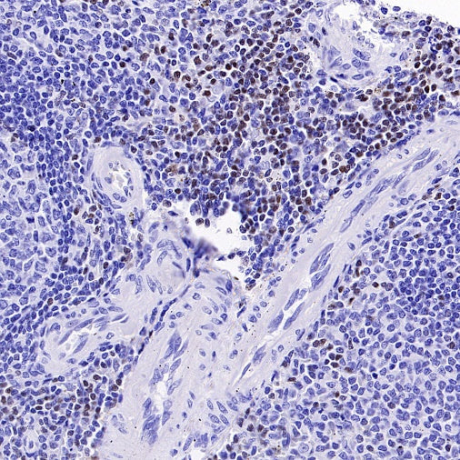 TCF1/TCF7 Recombinant Rabbit mAb (S-3486)