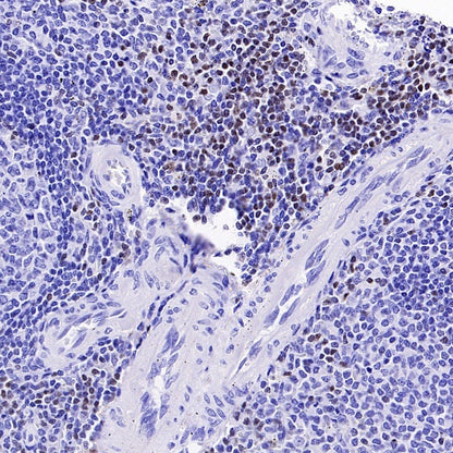 TCF1/TCF7 Recombinant Rabbit mAb (S-3486)