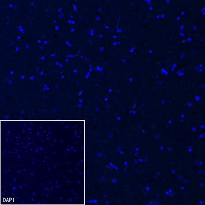 MYO7A Recombinant Rabbit mAb (S-2284-21)
