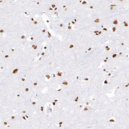 Anti-5-methylcytosine (5-mC) Recombinant Mouse mAb (S-3720)