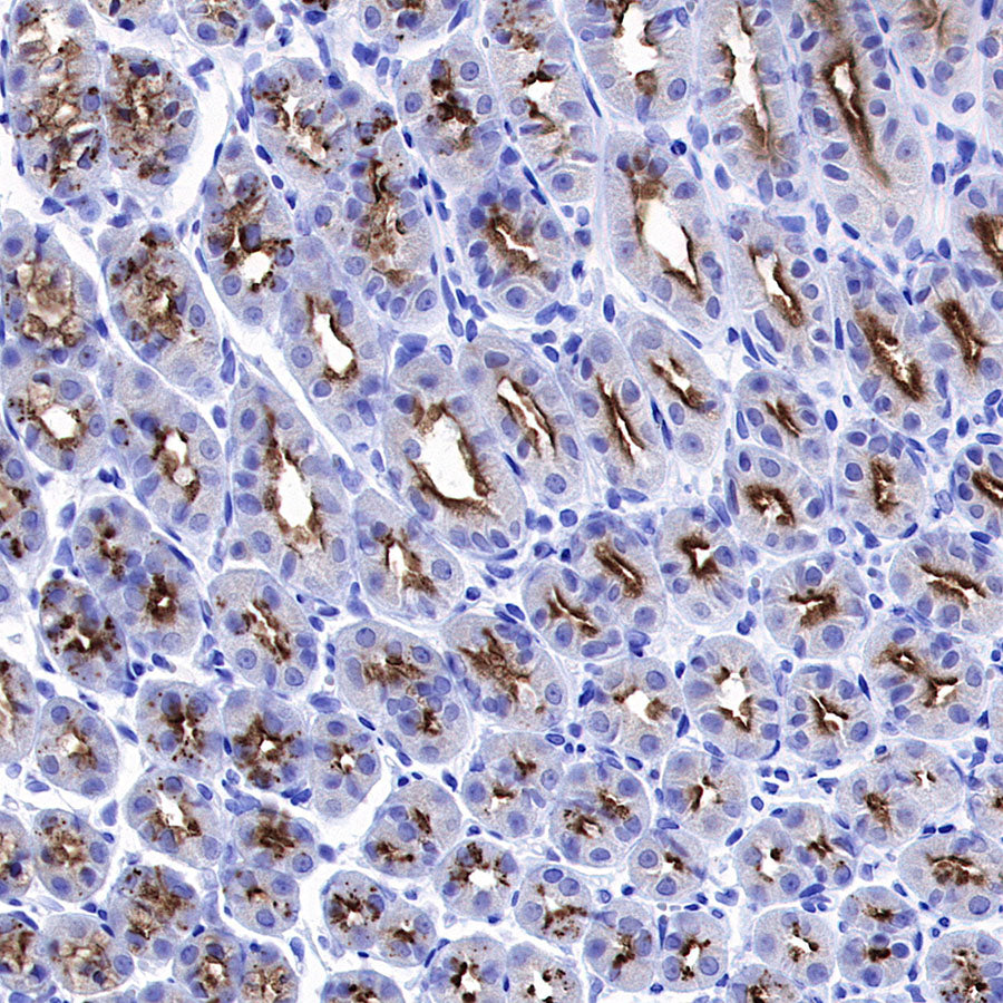 RAB27A Mouse mAb (S-M0050)