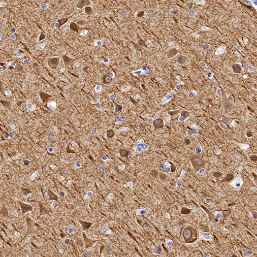 MAP2 Recombinant Rabbit mAb (SDT-2060-28)