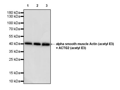 alpha smooth muscle Actin (acetyl E3) + ACTG2 (acetyl E3) Recombiant Rabbit mAb (S-3355)
