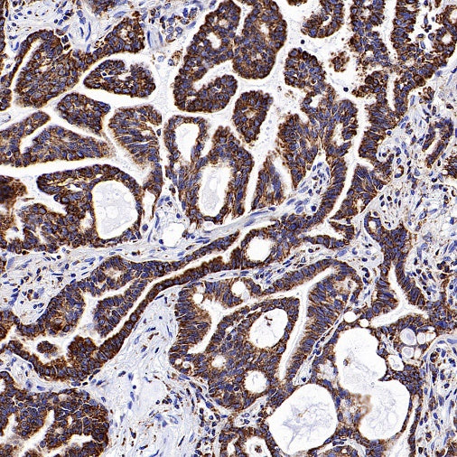 VDAC1 Recombinant Rabbit mAb (S-1877-18)
