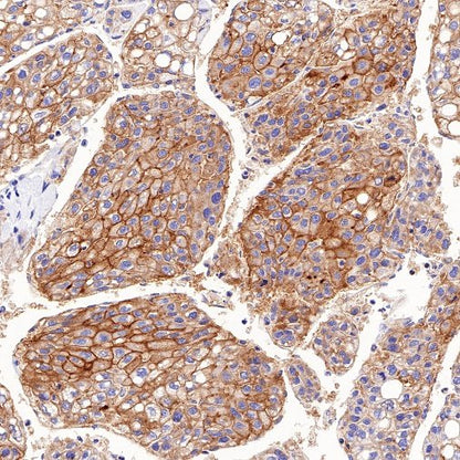 MDR1/ABCB1 Recombinant Rabbit mAb,PBS Only (SDT-872-21)