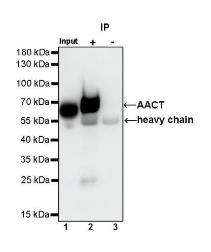AACT Recombinant Rabbit mAb (S-897-32)