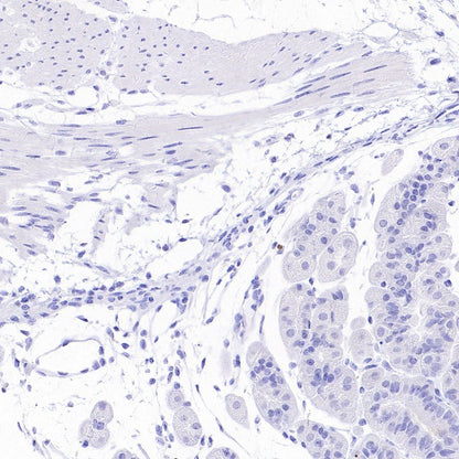 GRIA2 Rabbit Polyclonal Antibody