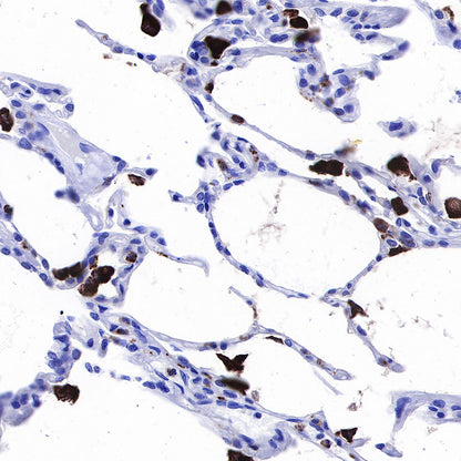 S-RMab® CD68 Recombinant Mouse mAb (SDT-R146)