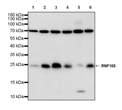 RNF166 Recombinant Rabbit mAb (S-3509-12)