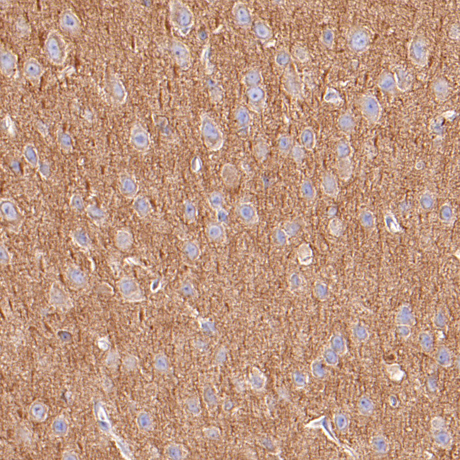 Alpha Tubulin Recombinant Mouse mAb (S-5704)