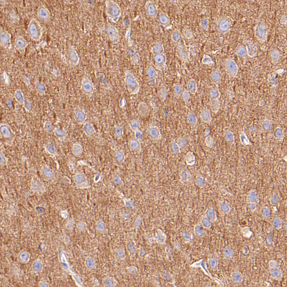 Alpha Tubulin Recombinant Mouse mAb (S-5704)
