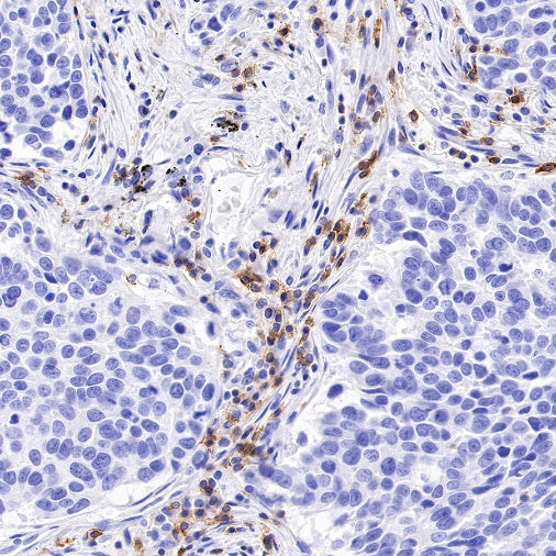 CD6 Recombinant Rabbit mAb (S-1512-39)