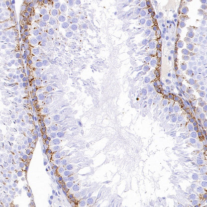 M6PR Recombinant Rabbit mAb (S-1480-21)