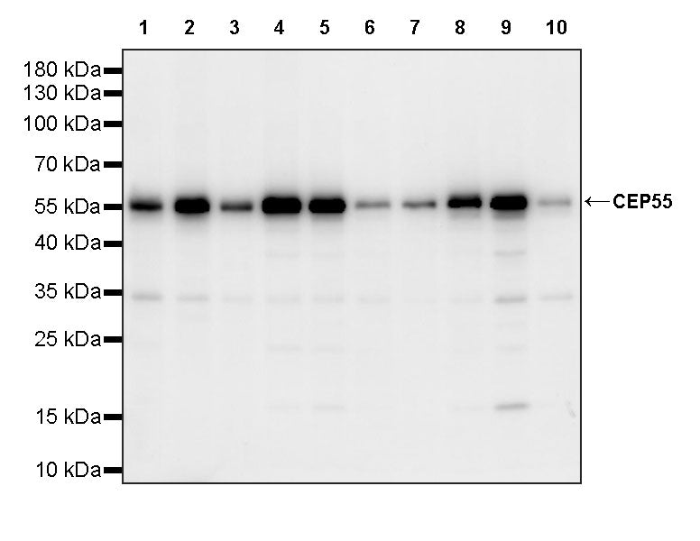 CEP55 Recombinant Rabbit mAb (S-3562-33)