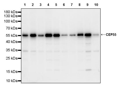 CEP55 Recombinant Rabbit mAb (S-3562-33)
