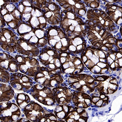 S-RMab® EpCAM Recombinant Rabbit mAb (SDT-078-128)