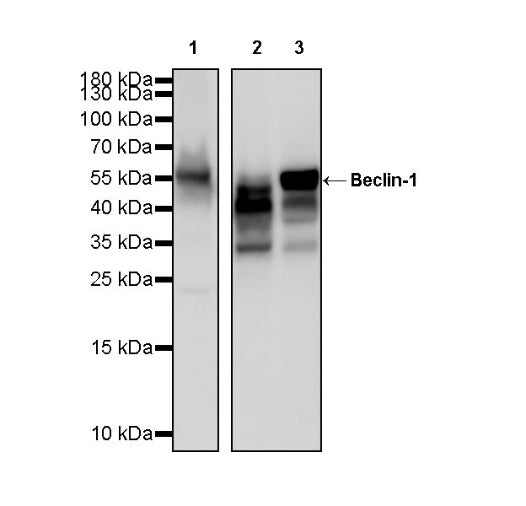 Beclin-1 Recombinant Rabbit mAb (S-761-15)
