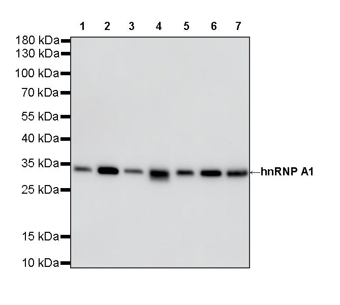 hnRNP A1 Recombinant Rabbit mAb