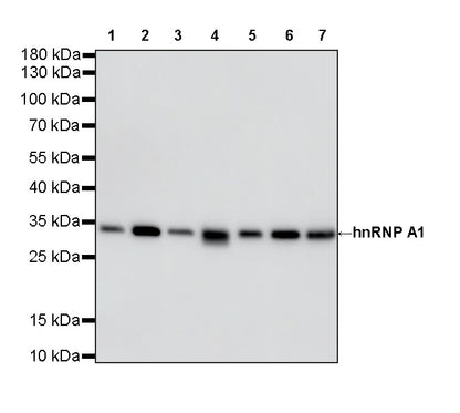 hnRNP A1 Recombinant Rabbit mAb