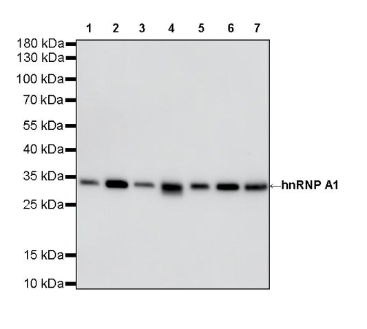 hnRNP A1 Recombinant Rabbit mAb
