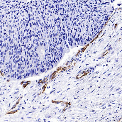 CD31 Recombinant Rabbit mAb (S-R568)