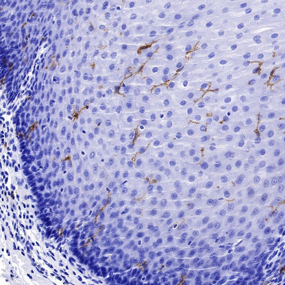 CD1a Recombinant Rabbit mAb (S-1486-65)