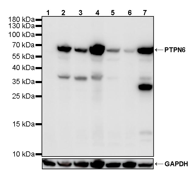 PTPN6 Rabbit Polyclonal Antibody