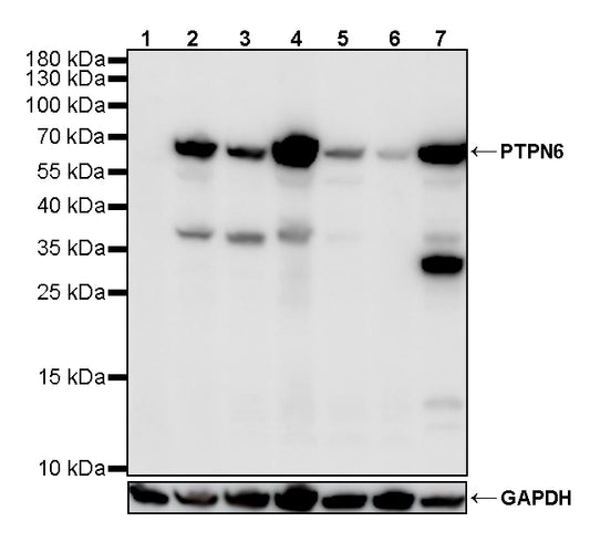 PTPN6 Rabbit Polyclonal Antibody