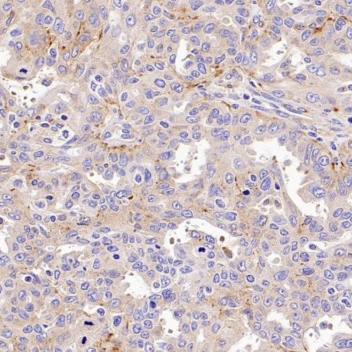 SIDT2 Recombinant Rabbit mAb (S-3763-76)