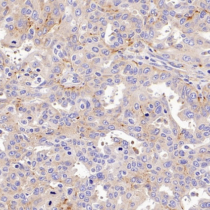 SIDT2 Recombinant Rabbit mAb (S-3763-76)