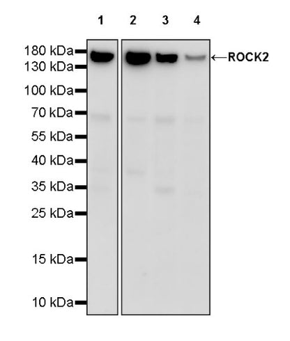 ROCK2 Rabbit Polyclonal Antibody