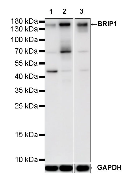BRIP1 Recombinant Rabbit mAb (S-4535-79)