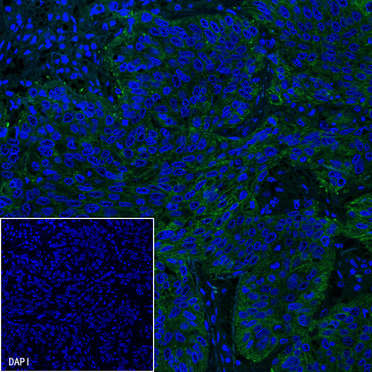 PD-L1 Recombinant Rabbit mAb,PBS Only (SDT-R017)