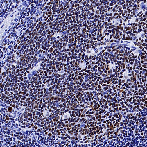 IKAROS Recombinant Rabbit mAb (S-729-146)
