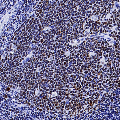 IKAROS Recombinant Rabbit mAb (S-729-146)