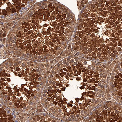 SBDS Recombinant Rabbit mAb (S-R344)