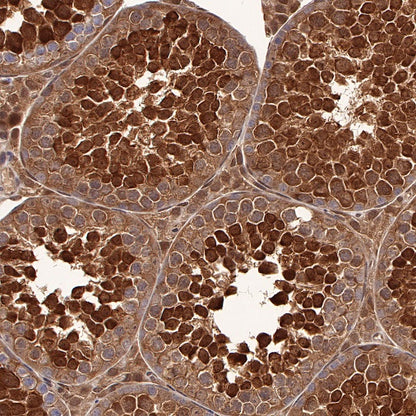 SBDS Recombinant Rabbit mAb (S-R344)