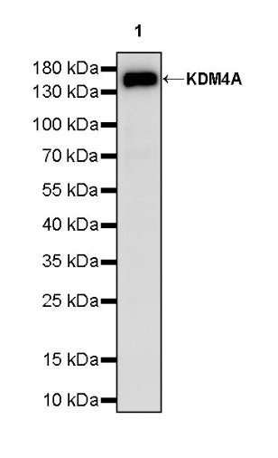 KDM4A Recombinant Rabbit mAb (S-957-138)
