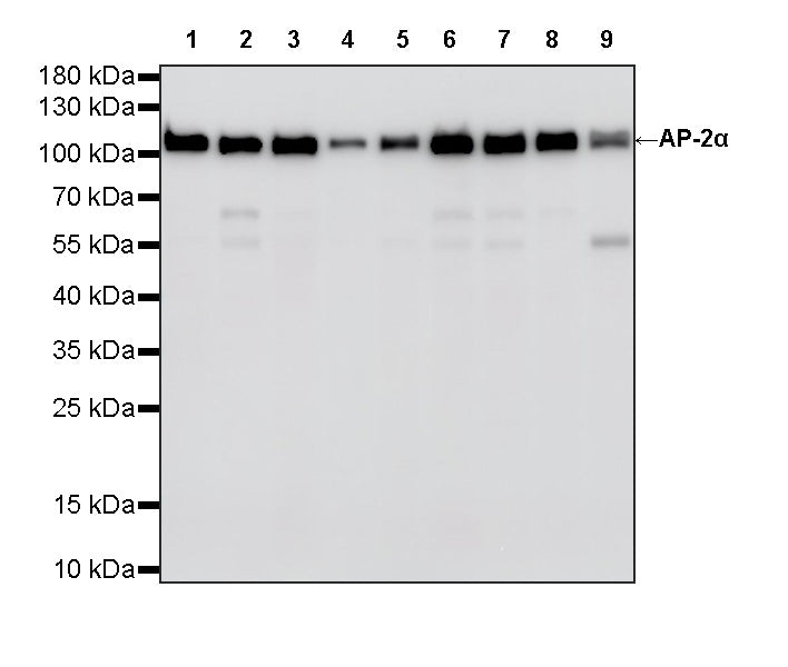 AP-2α Recombinant Rabbit mAb (S-4444-44)