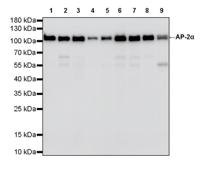 AP-2α Recombinant Rabbit mAb (S-4444-44)